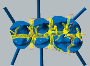 Cobalt-chrome Restmachining occlusal side